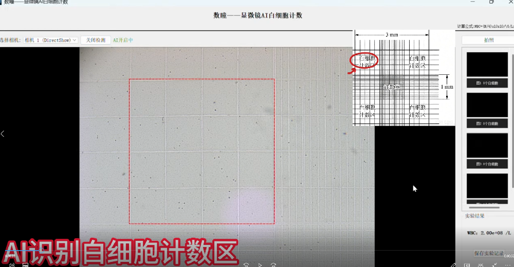 Leukocyte AI counting system